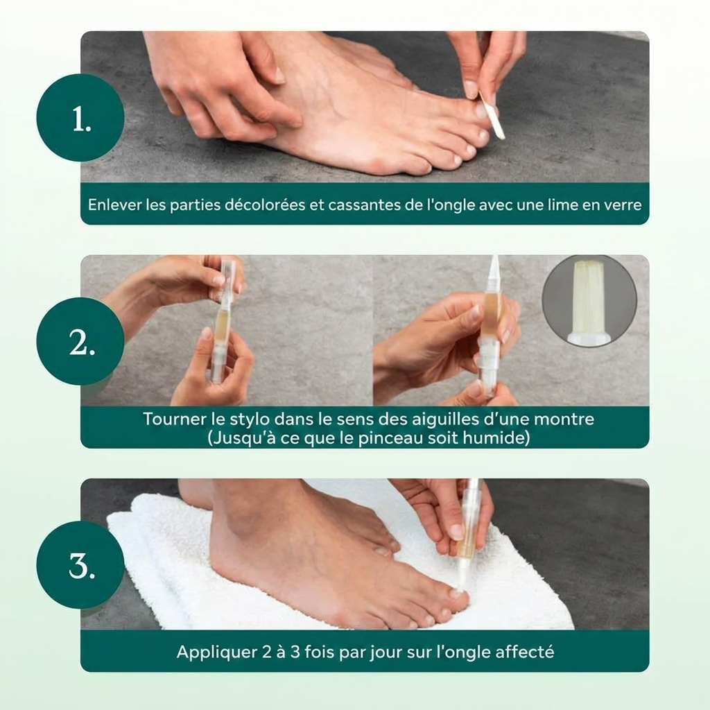 Flunail Stylo Anti-Mycose des Ongles — Technologie Nagelmatrix®