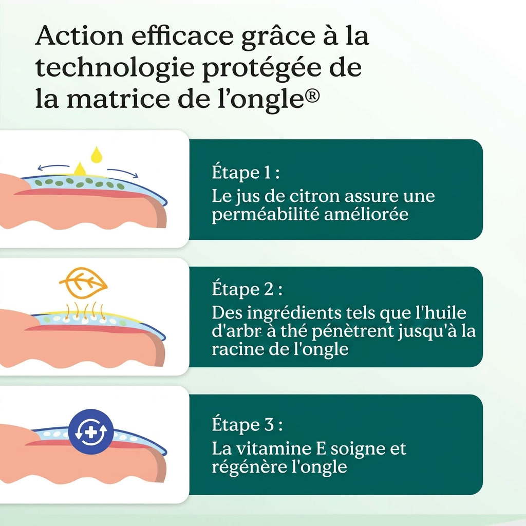 Flunail Stylo Anti-Mycose des Ongles — Technologie Nagelmatrix®